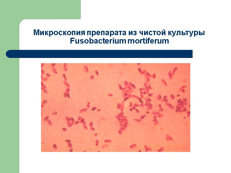 Микроскопия препарата из чистой культуры Fusobacterium mortiferum